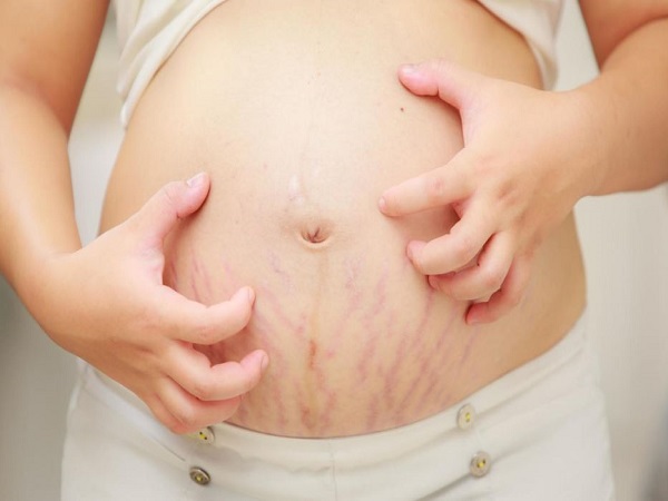 Nguyên nhân bầu bị ngứa bụng là gì?