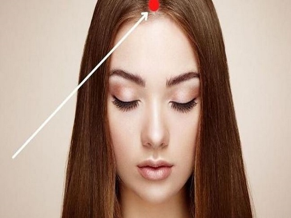 Nốt ruồi trên đỉnh đầu (Phúc Tinh)