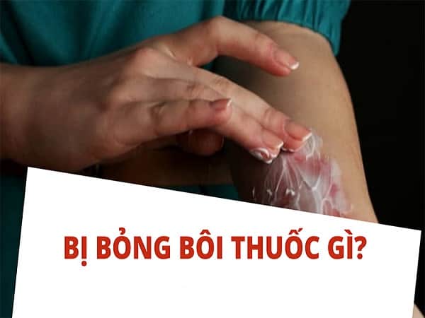 bị bỏng nên bôi gì