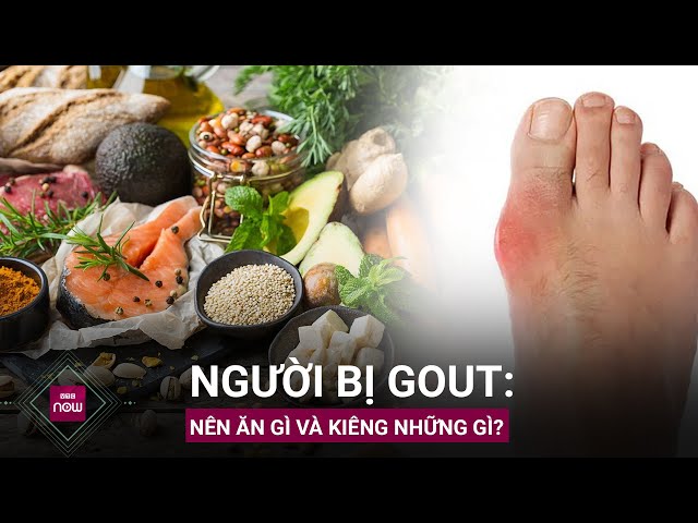 Bệnh gout kiêng ăn gì?