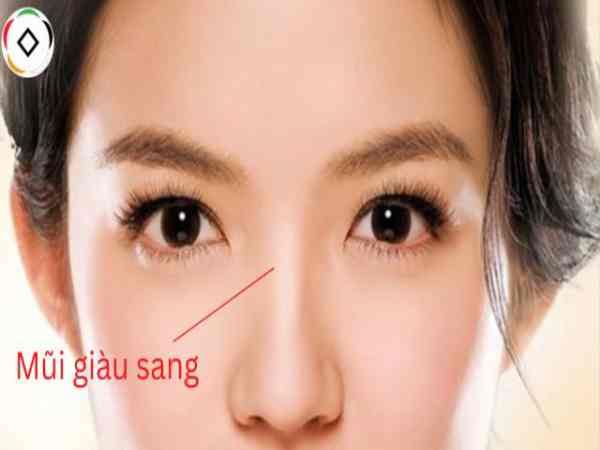 tướng mũi lân ở phụ nữ