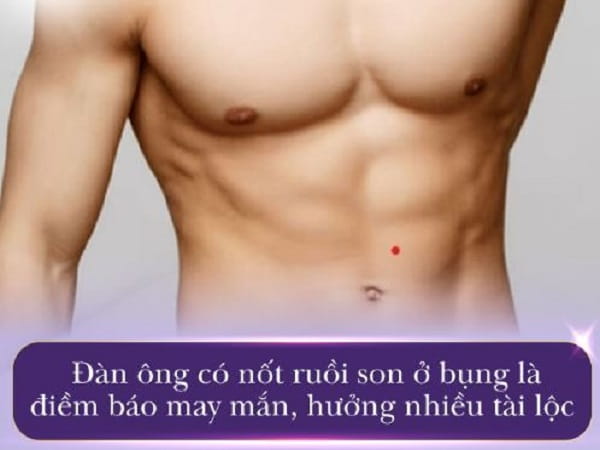 Nốt ruồi son ở bụng nam giới nói lên điều gì?